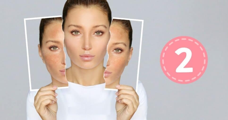Melhor que o Botox: Receita caseira com 2 ingredientes clareia manchas e rejuvenesce 15 anos
