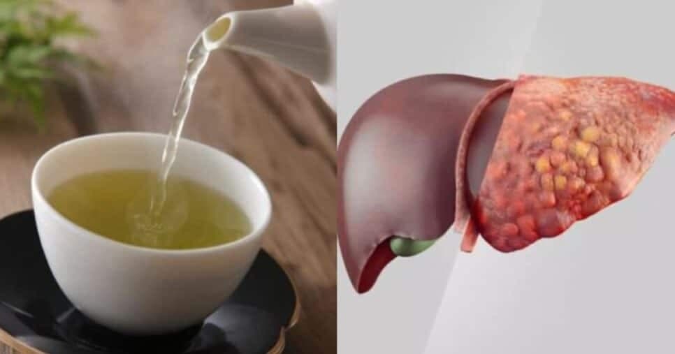 Adeus, gordura no fígado: Chá com planta popular limpa o corpo de dentro pra fora
