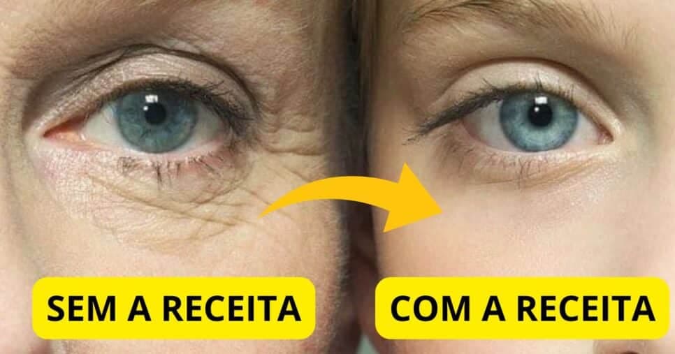 Fim das rugas: Mistura caseira com 4 ingredientes traz efeito botox instantâneo às 40+