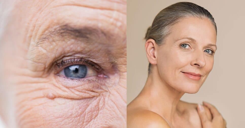 1 único ingrediente elimina sinais da idade de vez e deixa pele lisa como de porcelana do dia pra noite