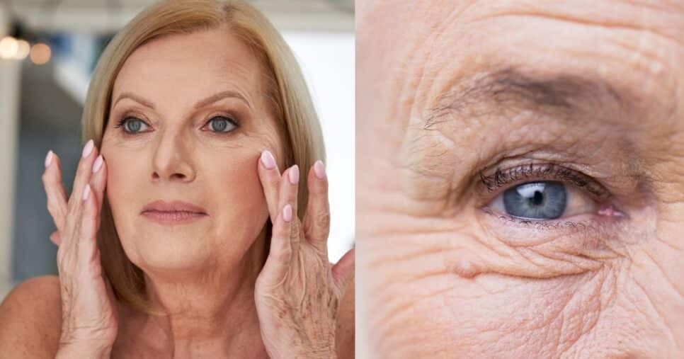 Harmonização facial com 2 ingredientes elimina rugas profundas (Reprodução/Montagem TV Foco/Canva)