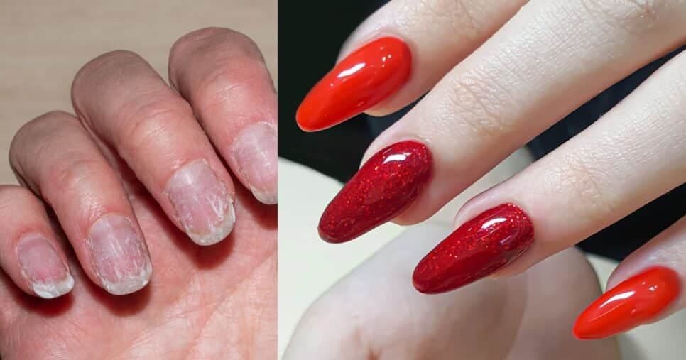 Manicures escondem: Produto n°1 de farmácia deixa unhas gigantes e inquebráveis por menos de R$ 10