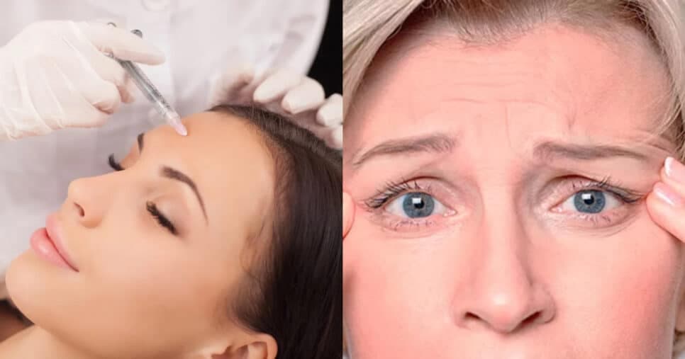Tchau rugas: Receita caseira com 5 ingredientes é mais potente que botox para as 50+