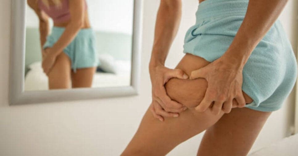 Veja como acabar com as celulites (Foto: iStock)