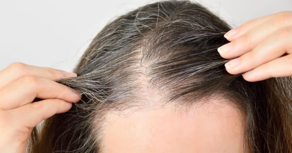 Senhoras 60+ pulando de alegria: Descoberto 1 único ingrediente capaz de reverter o cabelo branco em 2025