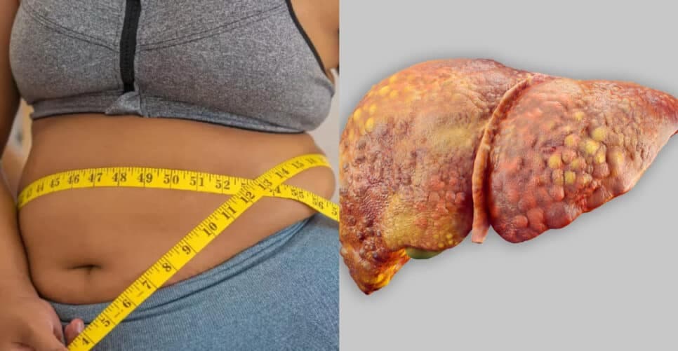 Suga gordura no fígado: 3 truques populares para eliminar colesterol e salvar às 60+