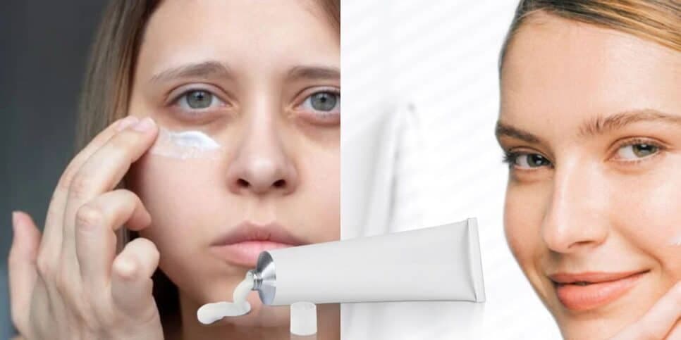 Pomada mágica tira rugas: Receita rejuvenescedora traz pele de seda e sem manchas do dia para noite