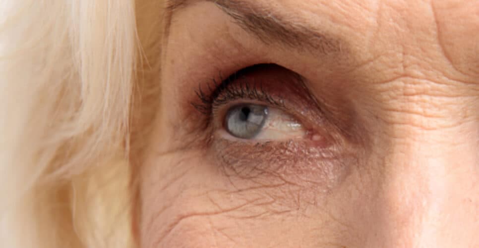 Tchau, rugas: 7 truques para paralisar o envelhecimento e rejuvenescer às 45+