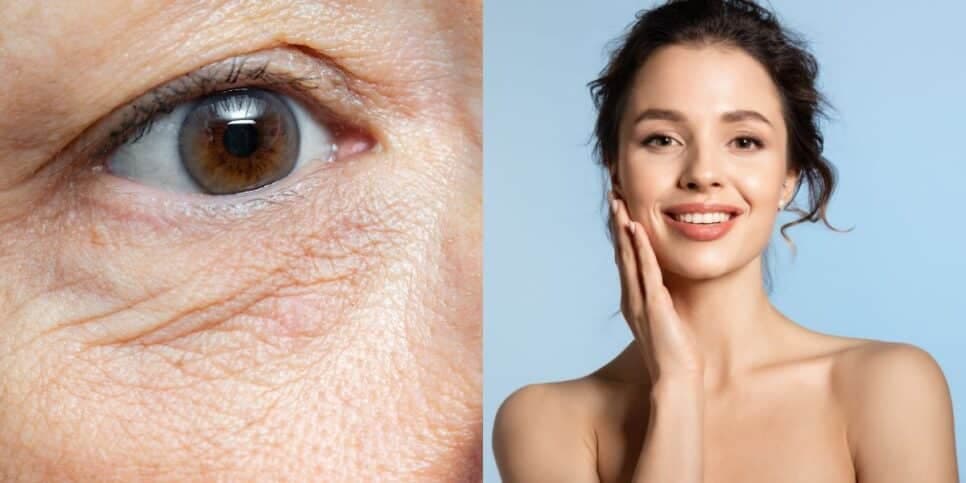 Adeus, rugas: 5 passos infalíveis para ter uma pele impecável e com carinha de 20 anos para sempre