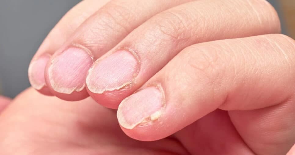Destroem suas unhas: 4 hábitos terríveis para eliminar da sua vida hoje