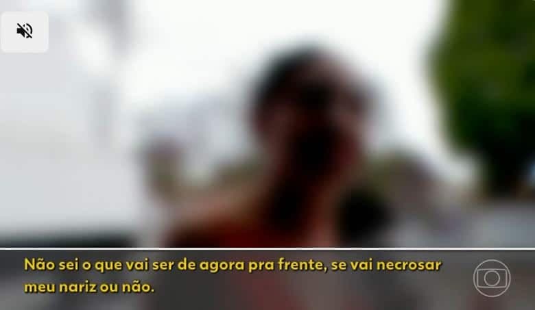 Depoimento de uma mulher que não quis se identificar, porém alega medo de necrose após procedimento (Foto Reprodução/Globo)