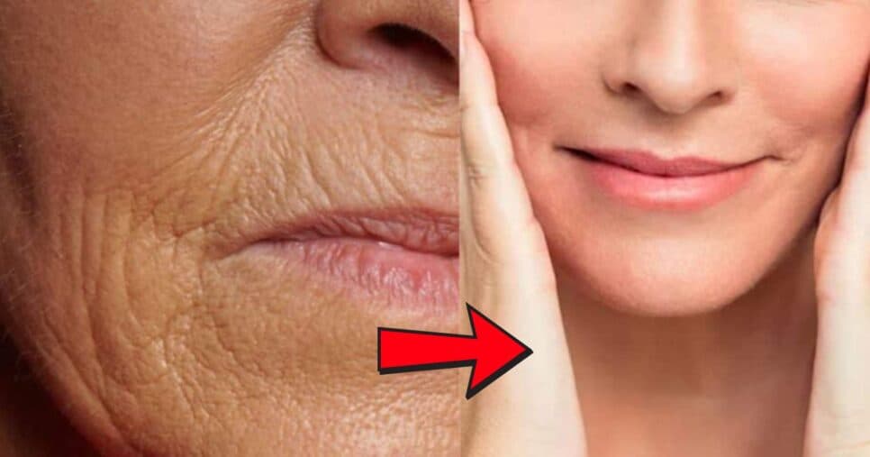 Fim das rugas e pele de seda sem plástica: Botox caseiro rejuvenesce 20 anos com apenas 2 ingredientes