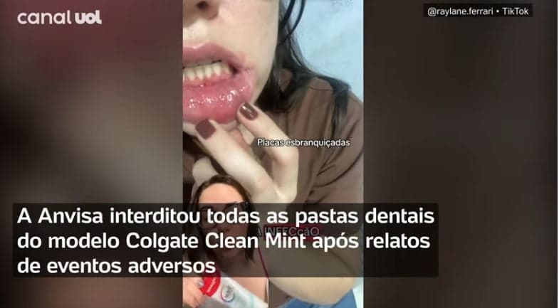 ANVISA entrou em cena após as pastas da marca serem denunciadas (Foto Reprodução/YouTube)