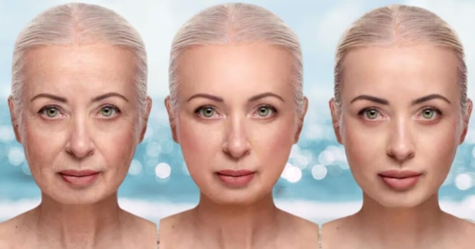Fim das rugas, manchas e olheiras: 5 passos fáceis e práticos para rejuvenescer a pele no verão
