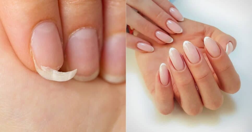 Falência das manicures: Mistura com 3 ingredientes fortalece, endurece e acelera o crescimento das unhas