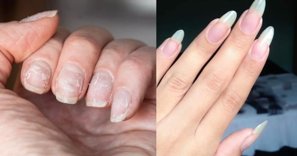 Manicures escondem: Base fortalecedora com 3 ingredientes deixa unhas gigantes e inquebráveis em 7 dias
