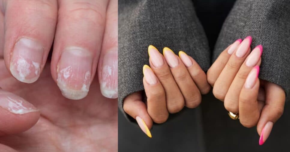 Fim da quebra e gastos com alongamento: Receitinha com 1 ingrediente faz unhas durarem quase eternamente