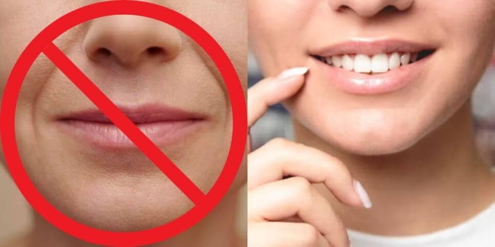 Fim do bigode chinês e+: Harmonização facial caseira com 1 ingrediente faz às 60+ ficarem com carinha de 30