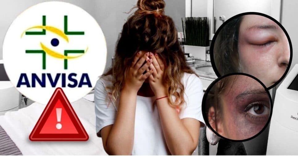 Inchaço e hematomas: Denúncia contra nº1 das donas de casa acende alerta da ANVISA em Campinas, SP