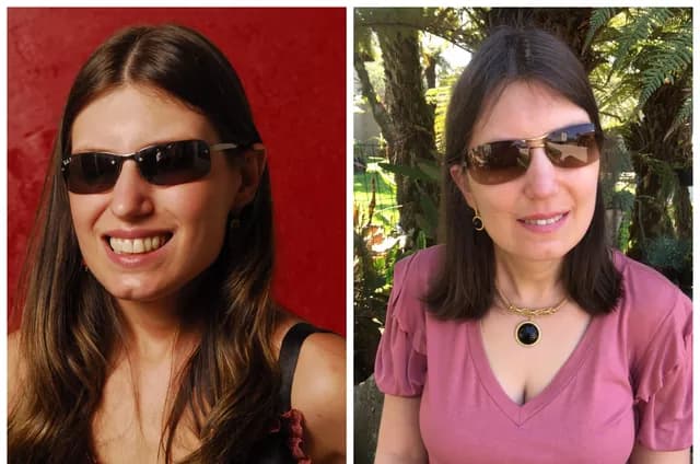Atriz cega de Caras & Bocas, da Globo, muda de profissão e vive assim (Foto: Reprodução/ Internet)