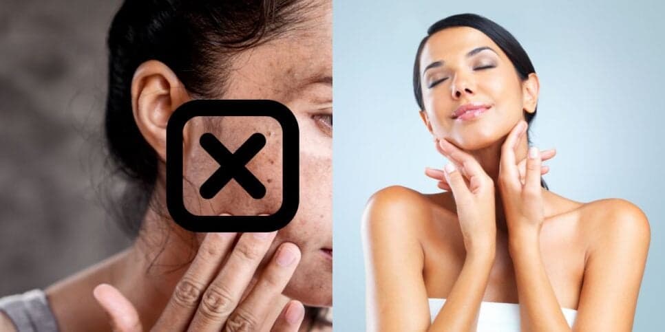 Adeus, manchas: Receita caseira com 3 ingredientes naturais para rejuvenescer a pele das mulheres 40+