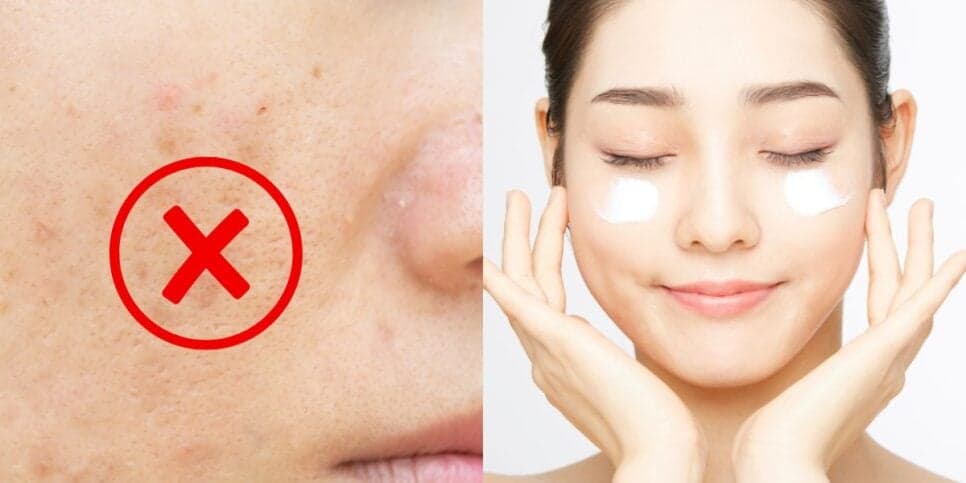 Rejuvenesce 20 anos: Creme caseiro com apenas 1 ingrediente clareia a pele das mulheres em 15 minutos