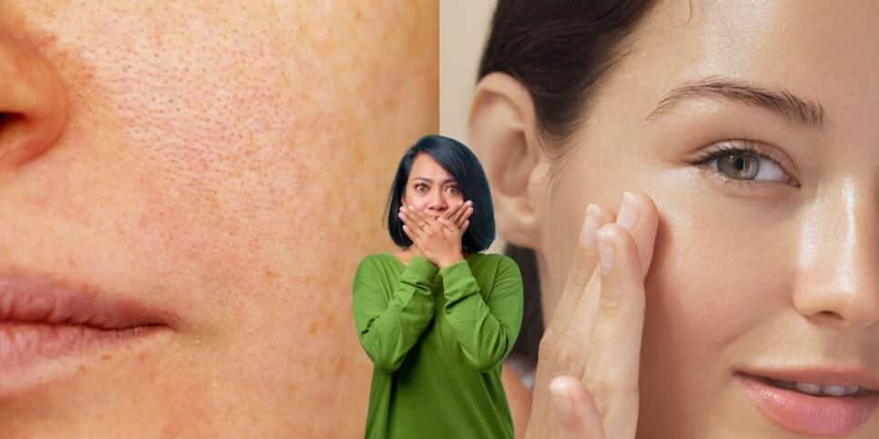 Pele de porcelana: 4 passos infalíveis para as mulheres 40+ darem adeus de vez as manchas no rosto