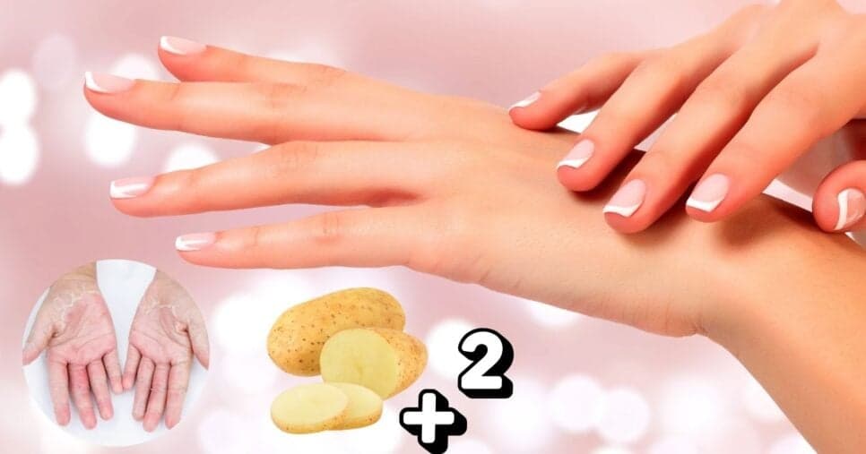 Segredo anti-idade: Receita com batata e +2 ingredientes deixam as mãos lisinhas, sem rugas e manchas