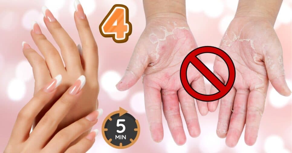 Mãos 30 anos mais jovem: Creme com 4 ingredientes acaba com ressecamento e calos em 5 minutos