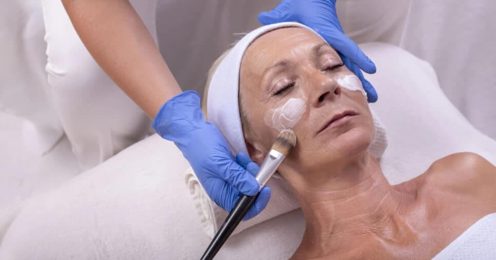 Peeling fenol pode ser substituído por esse creme (Foto: Divulgação)