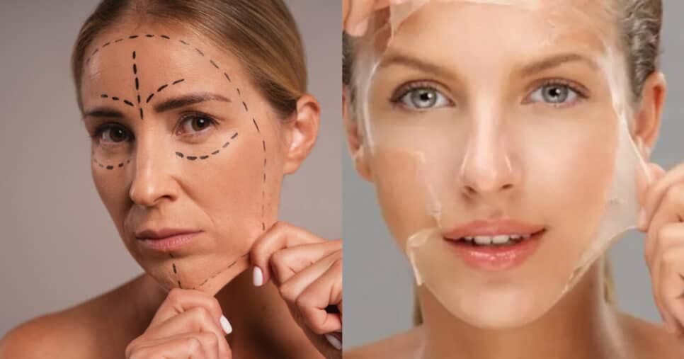 Tchau, flacidez: Peeling caseiro com ovo e +2 ingredientes infalíveis rejuvenesce as 60+ em 20 anos