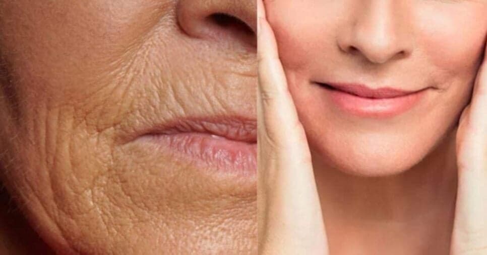 Melhor que ácido hialurônico: 1 ingrediente suga manchas e deixa pele brilhando sem oleosidade