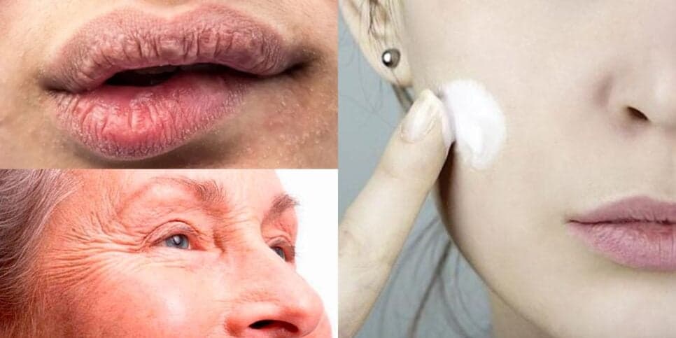 Adeus, rugas e lábios rachados: Receita com 2 ingredientes para mulheres 40+ começarem o Outono com pele lisa