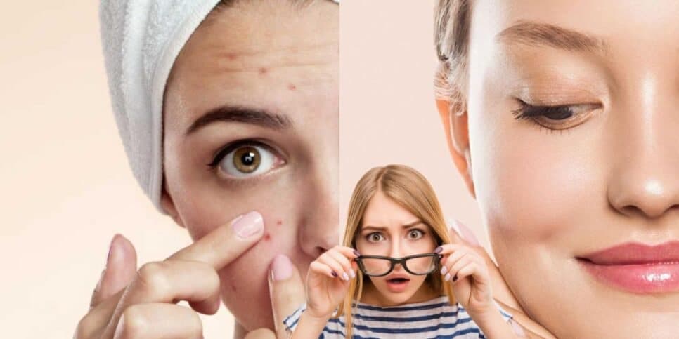 Adeus rugas e acnes: 1 único ingrediente popular garante pele lisa para as mulheres em 20 minutos