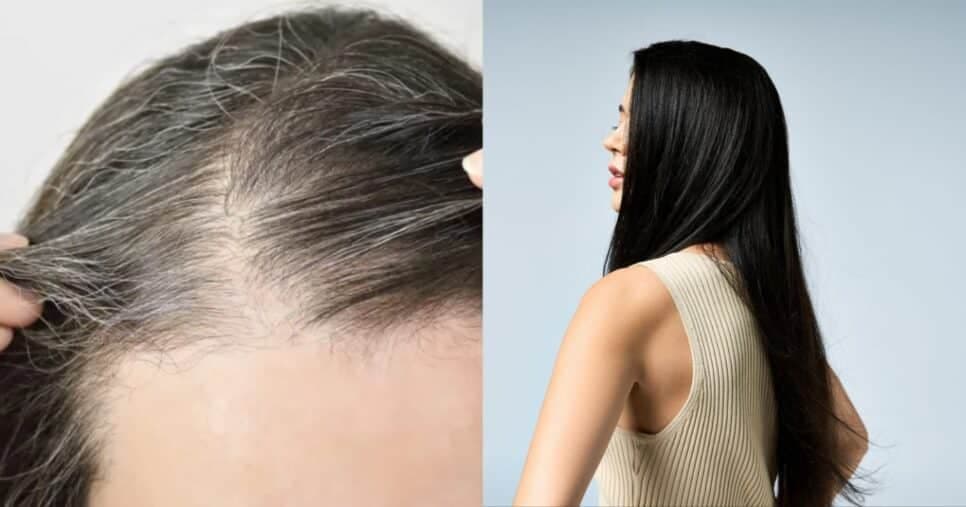 Falência dos salões: Misturinha com vinagre e +4 ingredientes aniquila os fios brancos sem precisar de amônia