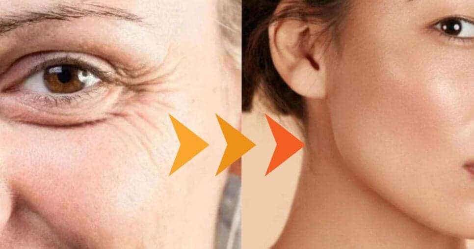 Sem rugas e 30 anos +jovem: Misturinha caseira com apenas 2 ingredientes te livra de plásticas AGORA