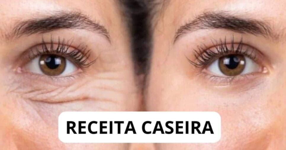 Botox caseiro: Vinagre e +1 ingrediente suga as rugas em 12 minutos e faz 60+ voltarem aos 30 outra vez