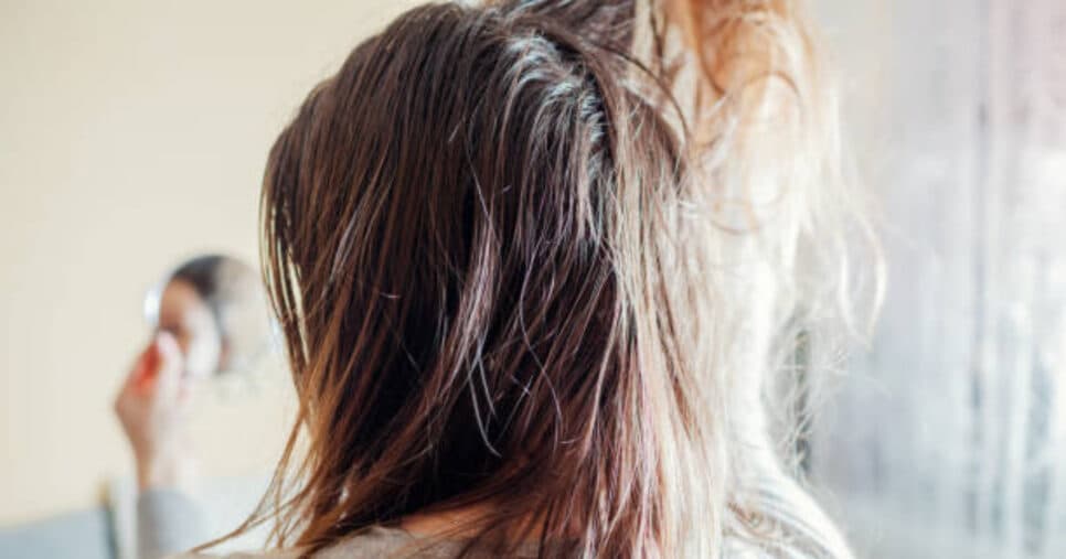 Fim da sujeira sem lavar todos os dias: 1 único produto da Skala dá fim ao cabelo oleoso por menos de R$8