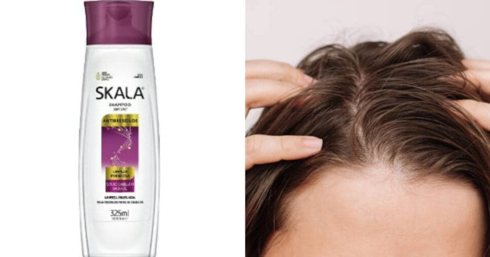 Conheça o shampoo para cabelos oleosos (Foto: Montagem TV Foco) Conheça o shampoo para cabelos oleosos (Foto: Montagem TV Foco)