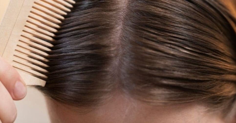 Cabelo oleoso nunca mais: 5 truques deixam o cabelo solto e pontas hidratadas