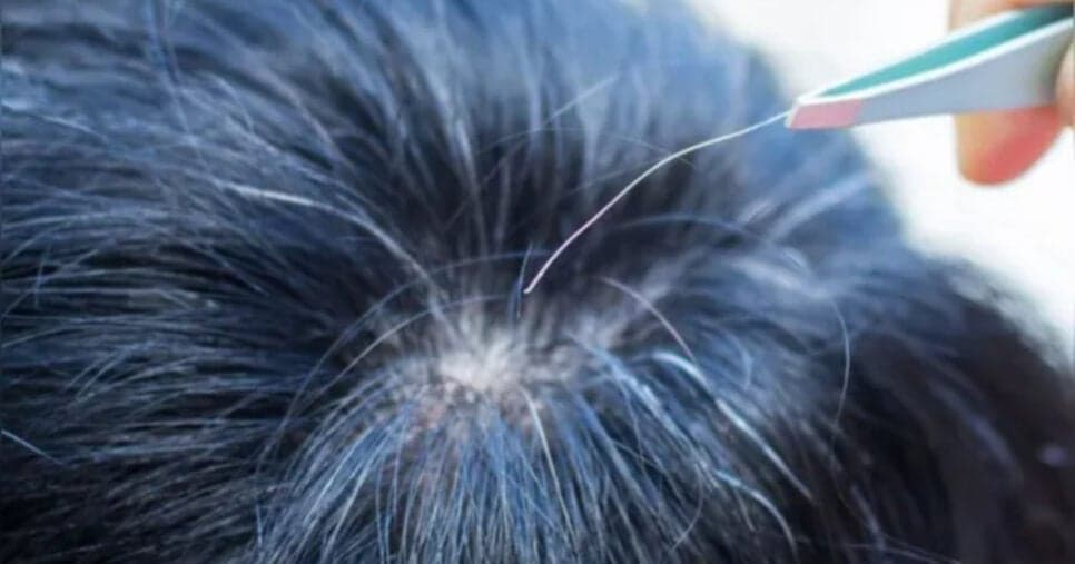 Extermina fios brancos: Único ingrediente popular elimina cabelo grisalho sem uso de tinta