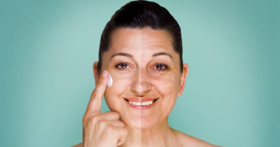 Dê adeus as manchas do rosto em 10 minutos: Receita caseira que rejuvenesce 30 anos com apenas 8 ingredientes