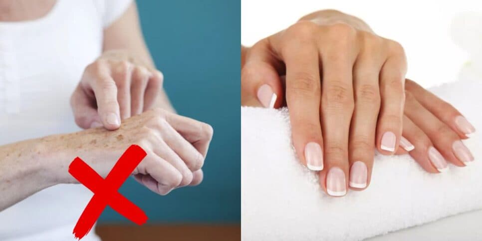 Mãos 30 anos mais jovens: Receitinha caseira com 3 ingredientes crava fim das manchas nas mulheres 40+