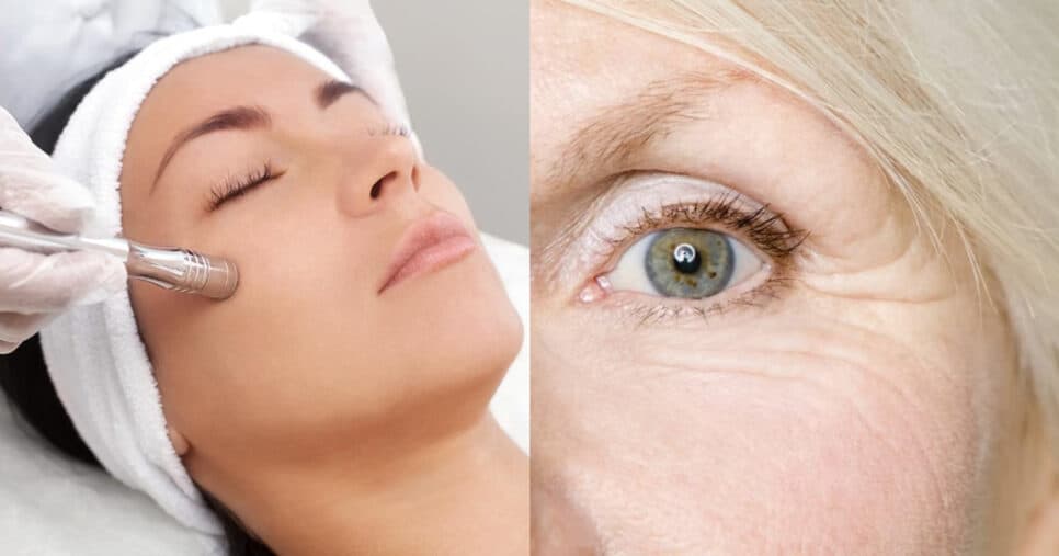 Pele de diamante e melhor que botox: Segredo antirrugas rejuvenesce as 50+ em 2025