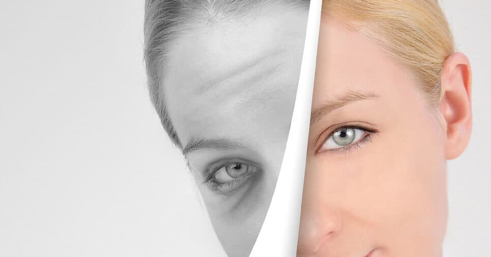 Suga as rugas: Máscara facial caseira te rejuvenesce 15 anos com apenas 6 ingredientes