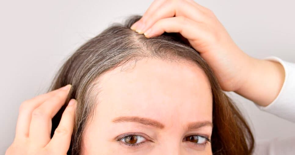 Falência da tinta: Mistura com 3 ingredientes escurece o cabelo branco e salva fios