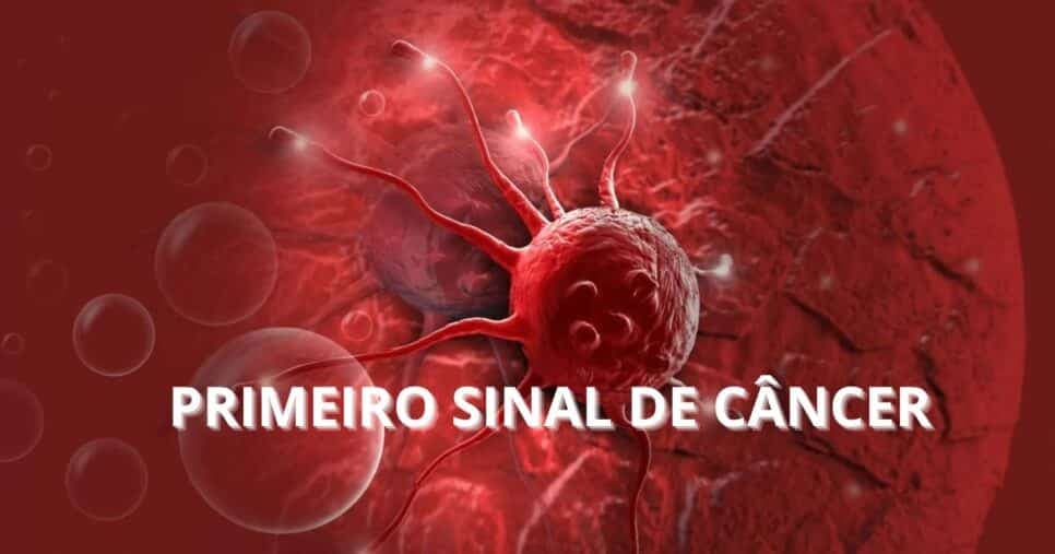 Câncer - Foto Internet