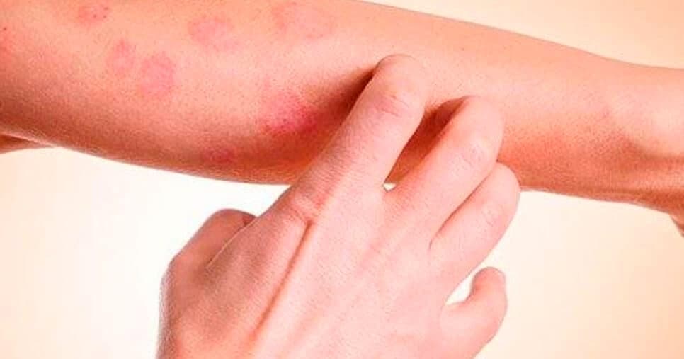 Cuidado: 5 sintomas silenciosos que indicam câncer de pele e você deve ir ao médico às pressas
