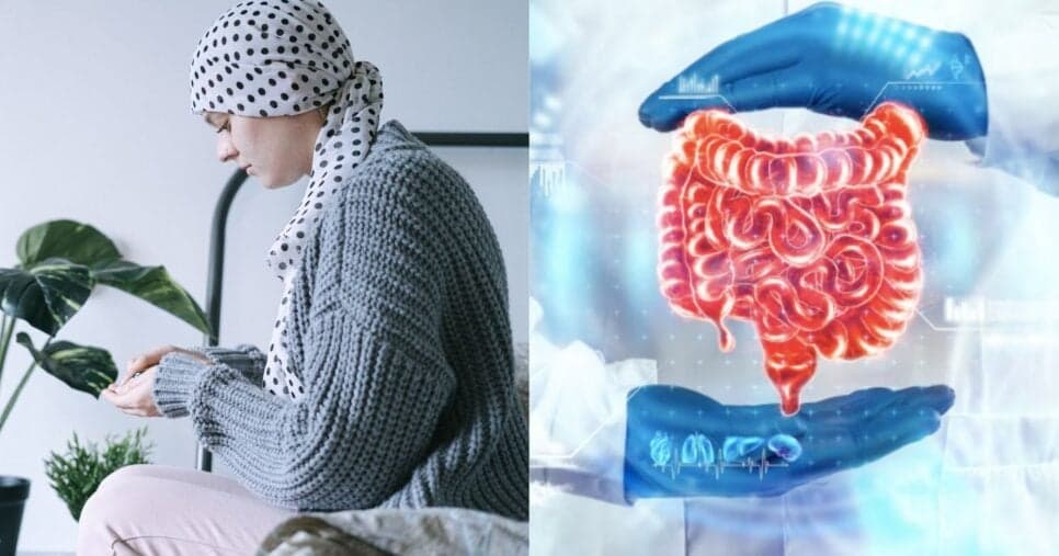 Atenção: 5 sintomas silenciosos que indicam câncer no intestino e você deve ir ao hospital IMEDIATAMENTE