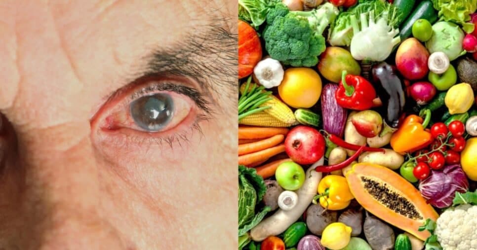 Fim da catarata: Especialista revela 6 alimentos para manter a saúde dos olhos